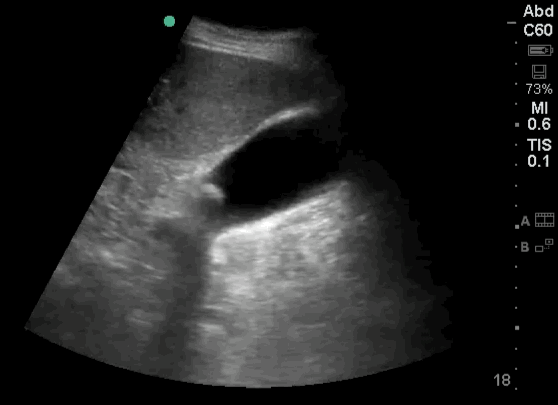 EEU case image missing